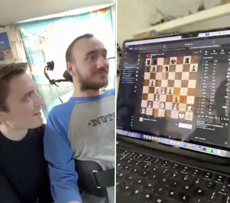 Neuralink ուղեղի իմպլանտով առաջին մարդը պատմել է իր փորձի մասին