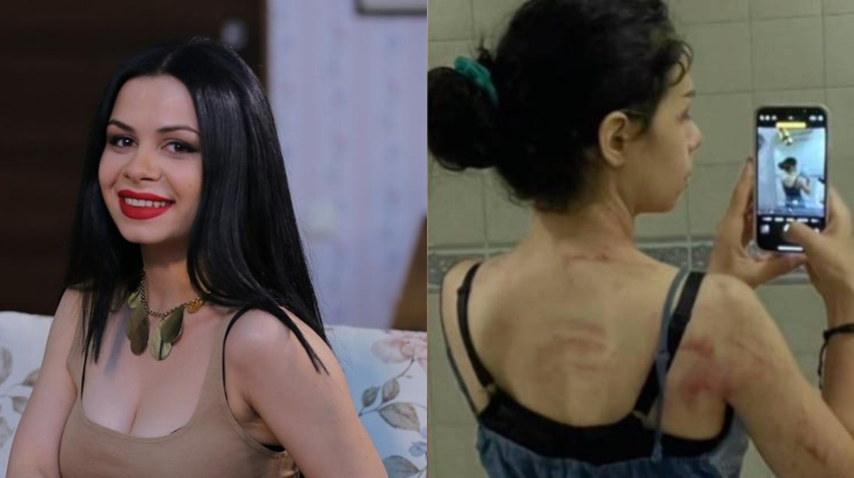 «Ազիզյաններ» սիթքոմից հայտնի Մարին իր պնդմամբ ամուսնու կողմից բռնnւթյան է ենթարկվել