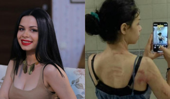 «Ազիզյաններ» սիթքոմից հայտնի Մարին իր պնդմամբ ամուսնու կողմից բռնnւթյան է ենթարկվել