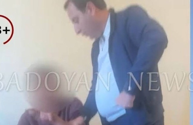 Օրերս  քաղաքացու նկատմամբ բռնություն կիրառած ոստիկանի նկատմամբ որպես խափանման միջոց կիրառվել է տնային կալանքը