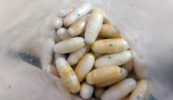 Հայաստանում Բրազիլիայի քաղաքացու մարմնից  բժշկական միջամտությամբ դուրս է բերվել 300 000 դոլար արժողությամբ թմրամիջոց․ ՊԵԿ (լուսանկար, տեսանյութ)